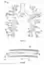 Fig. 05 - Medical device with procedure improvement features