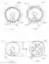 Fig. 14 - Medical device with procedure improvement features