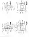 Fig. 10 - Bone fixation apparatus