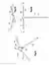 Fig. 14 - Bone fixation apparatus
