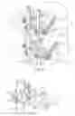 Fig. 05 - Spinal stabilization apparatus and method