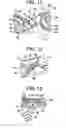 Fig. 07 - Apparatus for retaining a bone anchor in a bone plate and method for use thereof