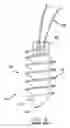 Fig. 06 - Method and apparatus for the repair of a rotator cuff (RTC) tendon or ligament