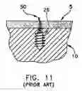 Fig. 09 - Method and apparatus for the repair of a rotator cuff (RTC) tendon or ligament