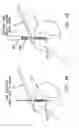 Fig. 33 - Method and apparatus for the repair of a rotator cuff (RTC) tendon or ligament