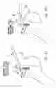 Fig. 35 - Method and apparatus for the repair of a rotator cuff (RTC) tendon or ligament