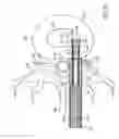 Fig. 14 - Disc annulus repair system