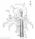 Fig. 15 - Disc annulus repair system