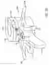 Fig. 33 - Disc annulus repair system