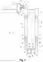 Fig. 02 - Orthopedic instrument