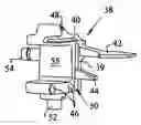 Fig. 01 - Method and apparatus for achieving correct limb alignment in unicondylar knee arthroplasty