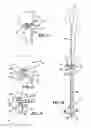 Fig. 07 - Method and apparatus for achieving correct limb alignment in unicondylar knee arthroplasty