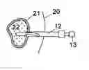 Fig. 01 - Sleeve, drill and puncture instrument