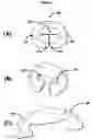 Fig. 03 - Instrument to insert a prosthetic implant