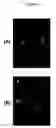 Fig. 04 - Methods and systems for characterizing intervertebral disc space