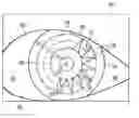 Fig. 01 - Surgical microscopy system and method for performing eye surgery