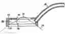 Fig. 01 - Corneal retention or stabilizing tool