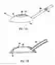Fig. 03 - Corneal retention or stabilizing tool