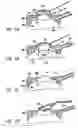Fig. 06 - Corneal retention or stabilizing tool