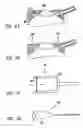 Fig. 07 - Corneal retention or stabilizing tool