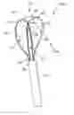 Fig. 01 - Laser resistant calculus retrieval device and method of using