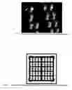 Fig. 03 - Micromachined tissue anchors for securing implants without sutures