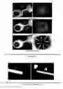 Fig. 04 - Micromachined tissue anchors for securing implants without sutures