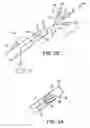 Fig. 03 - System and method for bonding closure of an intra-cardiac opening using energy