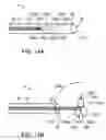 Fig. 13 - System and method for bonding closure of an intra-cardiac opening using energy