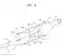 Fig. 05 - String cutting balloon
