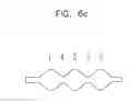 Fig. 09 - String cutting balloon
