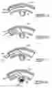 Fig. 04 - Method for placing a medical agent into a vessel of the body
