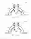 Fig. 09 - Surgical instrument system