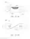 Fig. 63 - Surgical instrument system