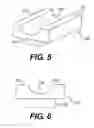 Fig. 05 - Compression device and method for shape memory alloy implants