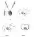 Fig. 08 - Subcutaneous cardioverter-defibrillator
