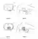 Fig. 15 - Subcutaneous cardioverter-defibrillator