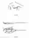 Fig. 19 - Subcutaneous cardioverter-defibrillator