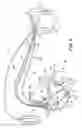 Fig. 03 - Multi-site PESP with fusion pacing