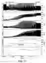 Fig. 19 - System for enhanced cardiac function with combined PESP/NES