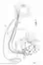 Fig. 03 - Measurement of coronary sinus parameters to optimize left ventricular performance