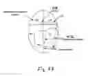 Fig. 09 - Measurement of coronary sinus parameters to optimize left ventricular performance