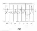Fig. 04 - Self-calibrating rate-adaptive pacemaker