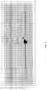 Fig. 05 - Atrial capture management in minimal ventricular pacing system and method