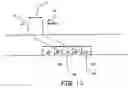 Fig. 15 - Atrial capture management in minimal ventricular pacing system and method