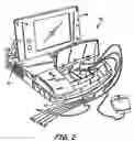 Fig. 03 - Electrical contact for a feedthrough/electrode assembly