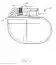 Fig. 02 - Radially sealing set screw