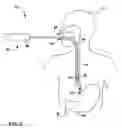 Fig. 04 - Intra-luminal device for gastrointestinal stimulation