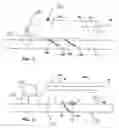 Fig. 07 - Intra-luminal device for gastrointestinal stimulation