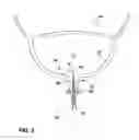 Fig. 03 - Flexible tube sensor for sensing urinary sphincter pressure